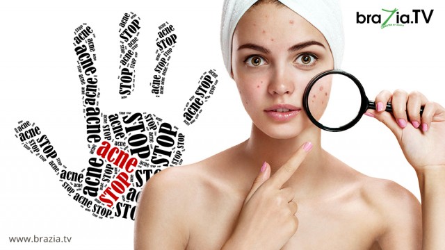 Things to “Do” and “Not Do” to clear up acne naturally!