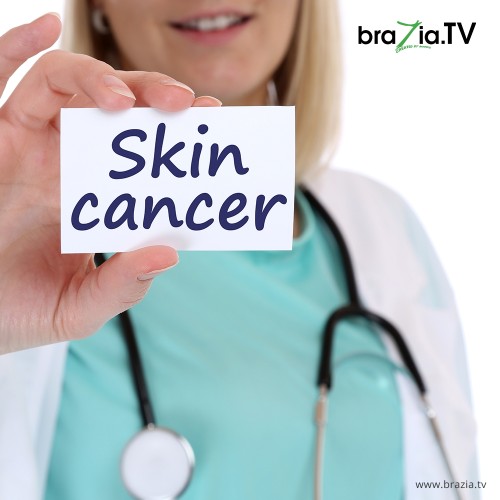 Skin Cancer - Take care of following signs