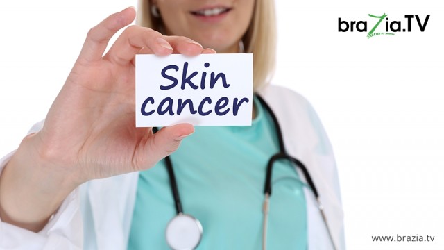 Skin Cancer - Take care of following signs